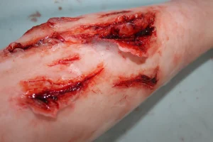 ForensicFX Studios Deep Leg Lacerations Prosthetic> Halloween Accessories