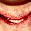 ForensicFX Studios Exposed Slit Throat Prosthetic> Halloween Accessories