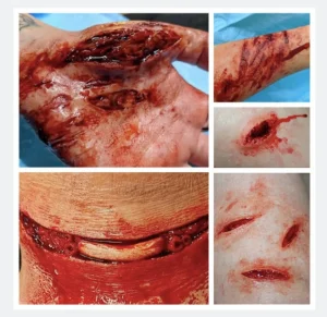 ForensicFX Studios Knife/Stab Wound Prosthetic Bundle> Halloween Accessories